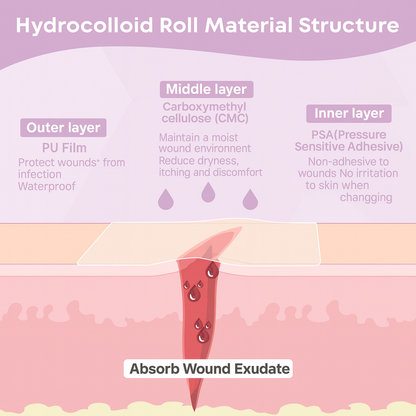 M&N Cut To Size Pimple Roll